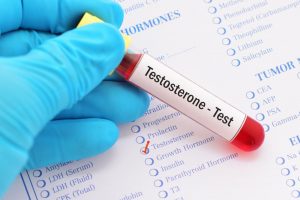 testosterone blood test CJA Balance Clinics UK